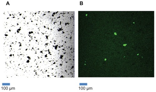 Figure 2 HPA-lectin-FITC-SWCNTs. A sample of functionalized SWCNTs conjugated to HPA-FITC was viewed under the confocal microscope, in transmission mode (A) and in fluorescence mode, following excitation at 488 nm (B). The results show that a proportion of the SWCNTs had been successfully conjugated to the FITC-labeled lectin.Abbreviations: FITC, fluorescein isothiocyanate; HPA, Helix pomatia agglutinin; SWCNT, single-walled carbon nanotube.