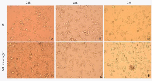 Figure 3 The morphologic changes of macrophages infected with TM conidia were observed by inverted microscope. With the prolongation of the infection process, the gemmation of conidia and mycelia increased, nutrient consumption in supernatant increased, the macrophages deformation, disintegration and death increased (B, D and F) compared with the control group (A, C and E). Light microscopy 400×.