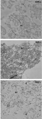 Figure 1.  Electron micrographs of plasma membranes isolated from SHR control rats (SHR-c), SHR rats treated with 2OHOA (SHR-t) and WKY rats treated with 2OHOA (WKY-t). No differences between control and treated WKY membranes were observed. Several bile canaliculi (BC) and regions of higher opacity (indicated by arrows) are shown.