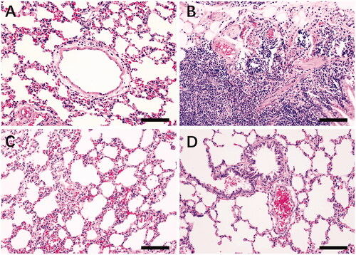Figure 7. Pathological observation of HE staining in the lung tissue of each group of rats (×200). (A) Control group; (B) model group; (C) levofloxacin hydrochloride group; (D) RYNM group. Severity of lesions in each group: B » C > A>D; infiltration of inflammatory cells: B » C > A>D.