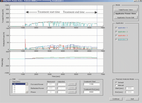 Figure 4. RF-power viewer: total power view, applicator power view and applicator power edit panels of RHyThM. Forward power, reflected power and phase are shown in the upper, middle and lower graphs, respectively. The left lower panel enables the user to adjust erroneous RF-power data. The right lower panel enables the user to select a time horizon for thermal analysis.