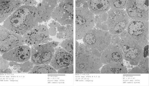 Figure 6 TEM images of bEnd.3 cells that were incubated with AmS-IONPs (left) or COOH-AmS-IONPs (right).Note: Electron-dense particles are visible in intracellular vesicles.Abbreviations: TEM, transmission electron microscopy; AmS-IONPs, aminosilanecoated iron oxide nanoparticles.