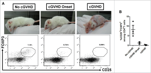 Figure 5. Absence of « chronic » GVHD development in AZA-treated mice is associated with high Treg frequency. NSG mice transplanted with 2 × 107 human PBMC and receiving or not AZA 5 mg/kg were monitored for survival and GVHD score (Figs. 2C and D). On day 60 post-transplantation, blood was harvested from surviving mice (only AZA-treated animals) and flow cytometry was performed to evaluate Treg frequency. (A) Mice were segregated in three groups according to « chronic » GVHD symptoms and Treg frequency was compared between the groups. (B) Frequency of Treg in each mouse of the three groups.
