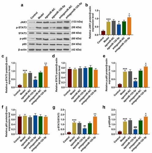 Figure 3. (a-h) Western blot was used to detect the expressions of JAK1, p-STAT3, STAT3, p-p65 and p65 in the Control, Model, agomiR-NC, agomiR-125-5p, antagomiR-NC, and antagomiR-125-5p groups. All the experiments have been performed in triplicate. β-actin was used as a control. *** P < 0.001 vs. Control; #P < 0.05, ## P < 0.01, ### P < 0.001 vs. agomiR-NC; ^ P < 0.05, ^^ P < 0.01 vs. antagomiR-NC