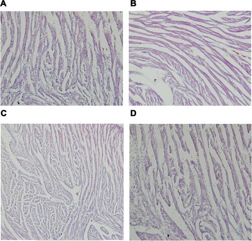 Figure 2 The changes of HE stain of gastrocnemius muscle in NCD (A), HFD (B), NCD+BBR (C), and FHD+BBR (D) groups.