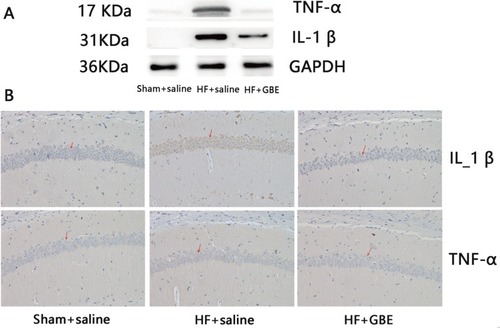 Figure 3 The response of inflammation. (A) The concentration of TNF-αand IL-1β in hippocampus detected by WB, and GAPDH as loading control. (B) The expression of TNF-α and IL-1β in hippocampus by immunohistochemistry, and the magnification was 100 times the original size. Red arrows indicate examples of the expression of related cytokines.