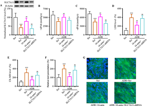 Figure 6 Inhibition of SLC7A11 inverted the effect of miR-16-5p in ADR-induced mice cardiac injury. (A) After transfection, Western blotting was performed to detect SLC7A11 expression. (B and C) After transfection, the heart’s performance was examined by performing a +dP/dt and -dP/dt measurement. (D and E) Total LDH and CK-MB activity in hearts were normalized to total protein content. (F and G) Both ELISA and immunofluorescence were used to evaluate product of lipid peroxidation. Data are reported from at least three independent experiments and analysed by independent one way ANOVA followed by Dunnett's post hoc test. **P < 0.01, ***P < 0.001 compared with Scr; ##P < 0.01, ###P < 0.001 compared with ADR+Scr; $P< 0.05, $$P < 0.01 compared with ADR+16-anta.