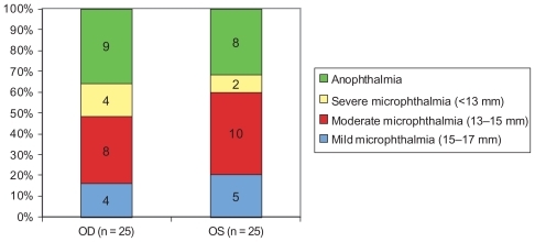 Figure 1 Diagnosis at baseline (n = 50 affected eyes).