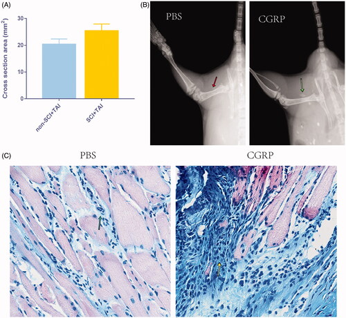 Figure 2. Directly injection of CGRP can promote callus formation in vivo. (A) The cross-sectional area of the callus is much larger in the SCI + TAI group than in the control (p = .003). (B) Directly injection of CGRP was able to induce the formation of cartilage/bone like tissues as shown by X ray of 2w post injection. (Red arrow: no cartilage/bone like tissue forms after PBS injection; Blue arrow: cartilage/bone like tissues forms after CGRP injection.) (C) The Alcian Blue staining of the samples 2w post injection. (Green arrow: limited areas of inflammatory infiltration; Yellow arrow: Chondrocytes formation after CGRP injection.)