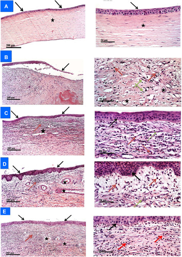 Figure 7 Histopathological changes observed, under two magnifications, in the sections of the excised corneal tissues in different groups [control (A), infected (B), drug suspension (C), G3 (D), G4 (E)]. The black arrow points to the epithelial layer, the green arrow shows the proliferating fibroblasts, and the red arrow refers to the polymorphonuclear inflammatory cells infiltrate. The stars denote the stromal collagen lamellar morphology (A), neovascularization (B), congested/dilated blood vessels (C–E).