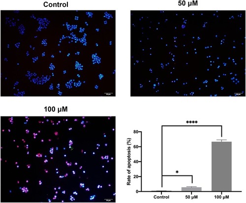 Figure 6 Cell apoptosis evaluated by TUNEL assay. The CAL 27 cells were treated with curcumin at indicated concentrations, followed by TUNEL assay. Red color is for TUNEL-positive cells, and blue color is for nucleus stained by DAPI. *P < 0.05 and ****P < 0.0001, one-way ANOVA.