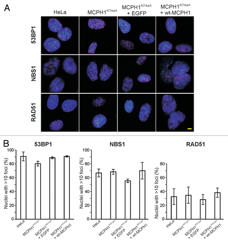 Figure 2 IRIF formation in MCPH1 patient cells. (A) Immunofluorescence micrographs showing 53BP1, NBS1 and RAD51 IRIF (red) in HeLa cells and transformed fibroblasts derived from a patient with a homozygous truncating MCPH1 mutation (c.427dupA/p.T143NfsX5) following irradiation with 10 Gy. The two righthand columns show fibroblasts from the same MCPH1 patient stably expressing EGFP or EGFP fused to wild-type MCPH1. Nuclei were counterstained with DAPI (blue). (B) Quantification of cells with >10 IRIF. Error bars indicate the SD of three different measurements, each numbering approximately 200 nuclei. Scale bar = 5 µm.