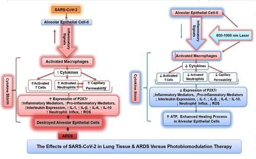 Figure 1 Comparison of cellular and molecular mediators in SARS-CoV-2 induced cytokine storm and following PBMT. PBMT (LLLT) reduces activated macrophages, which reduces pro-inflammatory cytokines. Reduced expression of P2X7r further reduces inflammatory mediators while increasing production of anti-inflammatory IL-10 and promoting the healing process. Simultaneously, an increase in ATP via parallel pathways promotes the healing process. ↑ indicates increase, ↓ indicates decrease. Figure adapted with permission from S Mokmeli, M Vetrici. Low level laser therapy as a modality to attenuate cytokine storm at multiple levels, enhance recovery, and reduce the use of ventilators in COVID-19. Can J Respir Ther 2020;56:1–7. doi: 10.29390/cjrt-2019-015.