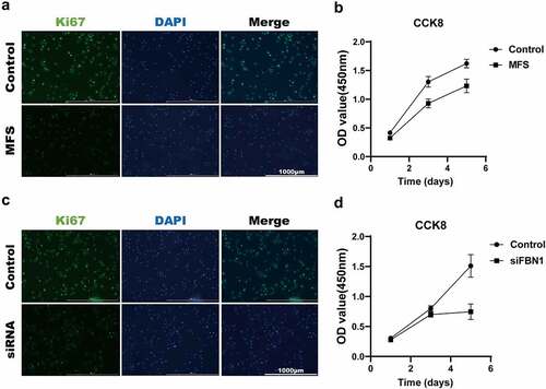 Figure 4. FBN1 deficiency inhibits the proliferation of MFS-HASMCs. (a, b) the proliferation levels of control-HASMCs and MFS-HASMCs were analyzed by immunofluorescence staining for Ki67 and CCK8 assay. Scale bar = 1000 μm.(c, d) the proliferation levels of control-HASMCs transfected with control-siRNA or FBN1-siRNA were analyzed by immunofluorescence staining for Ki67 and CCK8 assay. Scale bar = 1000 μm. Data are expressed as the mean ± SD. Source data are provided as a Source Data file.