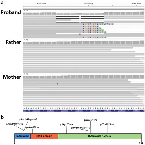 Figure 3. (a) Coverage and alignment tracks in the IGV browser. No read with the 20-bp deletion was found the parents’ data. Sequences of mismatched bases are shown. The reads with mismatched CGGCGGC are expected to contain the 20 nucleotides deletion due to misalignment because of the repeat in the reference sequence. (b) Previously reported predicted SOX2 protein familial variants