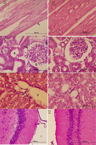 Figure 7. Tissue Histology. 5.1-5.2 Cardiac Muscle Histology. Endocardial simple squamous epithelium marked by black arrow, intercalated disk marked by white arrow, normal muscle striations are evidence throughout the tissue. 5.3-5.4 Renal Histology. Simple squamous epithelium (black arrow), Bowman space (B), glomerular basement membrane (white arrow tip), loop of Henle tubule (A) and proximal convoluted tubule (C), arterial pole (D). 5.5-5.6 Liver Histology. Portal triad composed of Portal vein (V), hepatic artery (black arrow) and bile duct (white arrow). 5.7-5.8 Brain Histology. Coronal cut through the medial thalamus (A) and surrounding third ventricle (B).