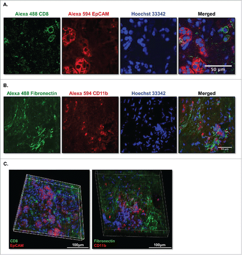 Figure 7. Multicolor immunofluorence images of live-stained culture slices. (A) PDA slices were stained with 10 μg/mL of Alexa Fluro 488 CD8 and Alexa Fluor 594 EpCAM (CD326) (N = 2) or (B) 10 μg/mL of Alexa Fluro 488 fibronectin and Alexa Fluor 594 CD11b antibodies for 3 h, followed by Hoechst 33342 nuclear stain for 5 min. Slices were then fixed and imaged by confocal microscopy. Bar = 50 μm. (N = 2) (C) The PDA slices of (A) and (B) were subjected to Z serial stack imaging (2 μm/stack) by confocal microscopy and were visualized in Volume views by Imaris software and Fiji Image J. Left panel, CD8+ (green), EpCAM+ (CD326) (red); right panel, fibronectin+ (green) and CD11b+ (red) and nuclei stain (blue) stained cells. Bar = 100 μm. (N = 2).