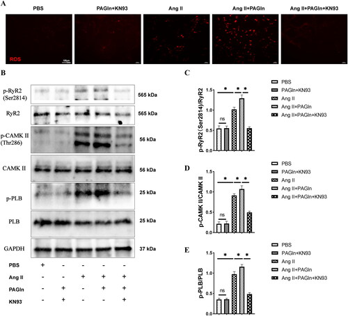 Figure 8. The CaMKII inhibitor KN93 alleviated the activation of CaMKII pathway in HL-1 cell treated with PAGln. (A) The images of ROS staining in Ang II-induced HL-1 cells treated with PBS, PAGln, KN93. (B) The images of p-CaMKII/CaMKII, p-PLB/PLB, p-RyR2/RyR2 Western blotting in HL-1 cells. (C) The statistical analysis of relative level of p-RyR2, and (D) the statistical analysis of relative level of p-CaMKII, and (E) the statistical analysis of relative level of p-PLB, showed that PAGln intervention promoted the relative level of p-RyR2, p-CaMKII and p-PLB increase in HL-1 cells, while the CaMKII inhibitor KN93 alleviated the increase of the expression of p-RyR2, p-CaMKII and p-PLB (n = 3). (The dose of reagent respectively: 1 μM Ang II, 1 μM KN93, 100 μM PAGln in vitro experiment.) Data are expressed as mean ± SD, two-way ANOVA followed by Bonferroni post hoc test. *P < 0.05; ns, not statistically significant. Ang II, angiotensin II; PAGln, phenylacetylglutamine; PLB, phospholamban; CaMKII, calcium/calmodulin-dependent protein kinase II; RyR2, ryanodine receptor 2.