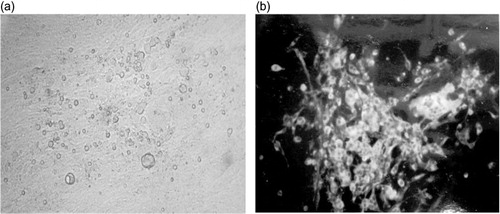 Figure 1. Immunofluoresence and CPE of MDV (652)-infected QM7 foci. QM7 cells were infected with MDV 652 for 7 days in DMEM/F12 with 3% FBS. 1a: CPE of 652/QM7-infected foci. 1b: Infected cells were then fixed and stained with a mixture of monoclonal antibodies H19 (anti-pp38) and 1AN86 (anti-gB). The negative control, QM7 co-cultivated with DEF, stained completely negative.
