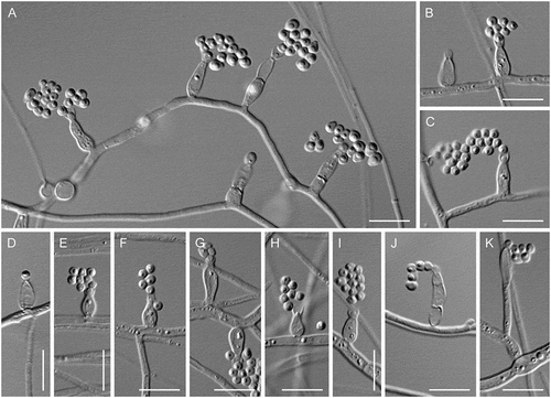 Figure 17. Psychrophila antarctica (ATCC 42793). A–K. Phialides with conidia (MLA slide culture, 13 d). Bars = 10 μm.