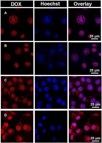 Figure 5 CLSM images of 4T1 cells treated with (A) DOX·HCl, (B) DOX·HCl+ICG (NIR), (C) PSC/ICG@+DOX nanoparticles (no NIR), and (D) PSC/ICG@+DOX nanoparticles (NIR).