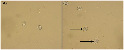 Figure 1. Photomicrographs of oocysts of E. tenella. (A) Morphology of oocysts in the normal group. (B) Morphology of oocysts after FMTE treatment (400 µg/mL) for 7 d, the internal structures of coccidioides were damaged (→).
