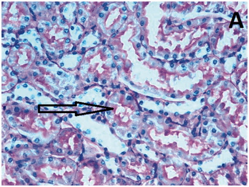 Figure 2. View of brush border in renal tissue in Group C.