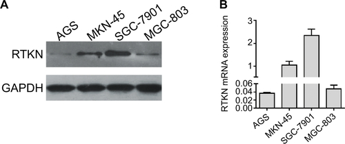 Figure S1 RTKN protein (A) and mRNA (B) levels were evaluated in four GC cell lines.Abbreviation: GC, gastric cancer.
