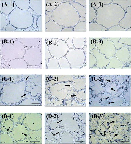 Figure 3 Light microscopy images of fresh and frozen mangoes. (a) Fresh Nam Dok Mai, (b) fresh Chok Anan, (c) frozen Nam Dok Mai, and (d) frozen Chok Anan. (1) Partially ripe, (2) ripe, and (3) fully ripe stage. Arrows indicate the swelling of cell walls caused by freezing damage. T = torn cell wall. Bar = 50 μm. (Color figure available online.)