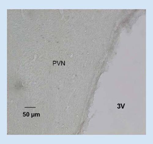 Figure 2. Photomicrographs showing the expression of c-Fos protein in the rat paraventricular nucleus of the hypothalamus.The elevated c-Fos expression induced by acute morphine administration (Figure 1B) is completely attenuated in rats receive co-injection of gabapentin (150 mg/kg, i.p.) and morphine (10 mg/kg, i.p.) (Figure 2) p < 0.01. Nuclei immunoreactive for c-Fos protein appear as black staining. Scale bar = 50 μm.3V: Third ventricle; PVN: Paraventricular nucleus.