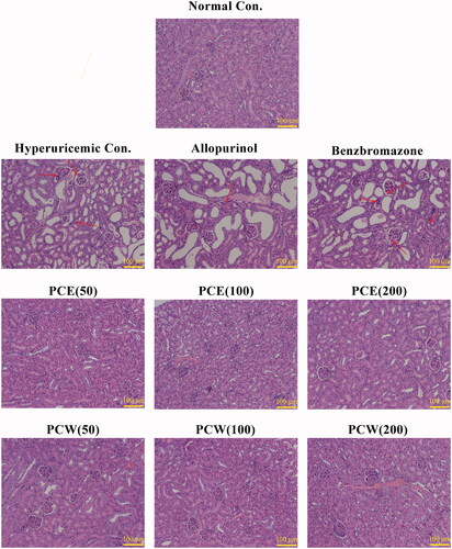 Figure 2. Histological micrographs of kidney tissues stained with H&E: normal control, hyperuricemic control, allopurinol control (5 mg/kg), benzbromarzone control (7.8 mg/kg), PCE (50 mg/kg), PCE (100 mg/kg), PCE (200 mg/kg), PCW (50 mg/kg), PCW (100 mg/kg) and PCW (200 mg/kg). Magnification, ×200 ×; scale bar, 100 μm; red arrow, necrotic and/or inflammatory foci.