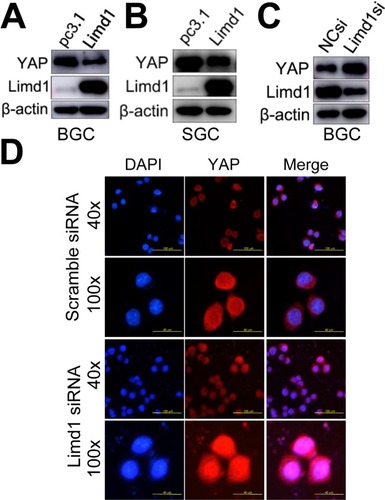 Figure 4 LIMD1 suppresses YAP1 expression and translocation from the cytoplasm into the nucleus.Notes: (A–C) YAP1 expression in LIMD1-overexpressing (A and B) and LIMD1-downexpressing (C) GC cells is shown. The names of the cell lines are indicated below the panels. (D) Localization of YAP1 in BGC823 cells transfected with scramble siRNA and LIMD1 siRNA is shown by immunostaining of YAP1. Each panel represents at least three independent experiments. LIMD1, LIMD1 overexpression vector; pc3.1, empty vector.Abbreviations: GC, gastric cancer; LIMD1si, LIMD1-siRNA; mAb, monoclonal antibody; NCsi, negative control siRNA.