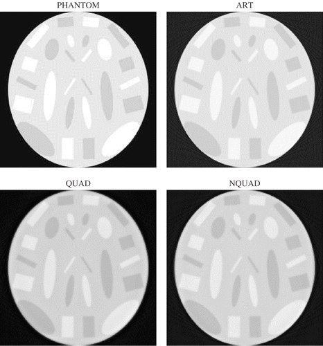 Figure 7. Case 3: phantom and reconstructed images after 10 iterations.