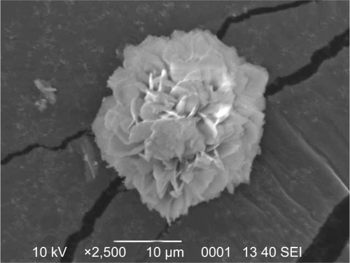 Figure 6 Scanning electron micrograph of hydroxyapatite carrier for additional formulation.