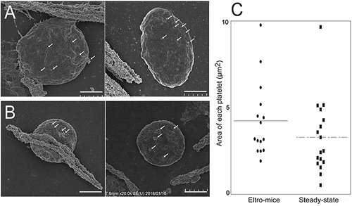 Figure 4. SEM observation of human CD41-positive platelets.Human CD41-positive cells were isolated from the PRP from eltro-mice (A) or steady-state-mice (B). Representative magnetic bead-attached human CD41-positive platelets are shown. The values of areas from the SEM images are shown as the dotplots. The average are shown as lines (n = 15–17) (C). Scale Bar = 1 μm. White arrows in A and B indicate magnetic beads.