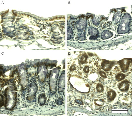 Figure 6. 8-OHdG immunohistochemistry of DSS-induced colitis in young rats. 8-OHdG was immunopositive at the surface epithelium in the colon of young rats (A). After DSS treatment, 8-OHdG immunoreactivity in the surface epithelium increased at DSS-3d (B), in crypt cells at DSS-5d (C), and in the vast majority of enterocytes at DSS-7d (D). Scale bar = 50 µm.
