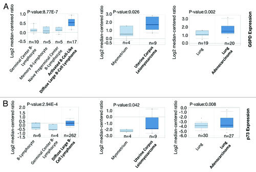 Figure 5. G6PD and p73 are frequently overexpressed in many human cancers (A and B) Box plot comparing TP73 and G6PD transcript levels in diffuse large B-cell lymphoma,Citation36,Citation37 uterine corpus leiomyosarcoma,Citation38 lung adenocarcinoma,Citation39,Citation40 and their counterparts. The graphs were derived from published data available through the ONCOMINE database. The differential gene expression data are centered on the median of expression levels and plotted on a log2 scale. The P value was calculated using a 2-sample t test. Whiskers indicate minimum and maximum data values that are not outliers. The number of samples (n) in each class is indicated.