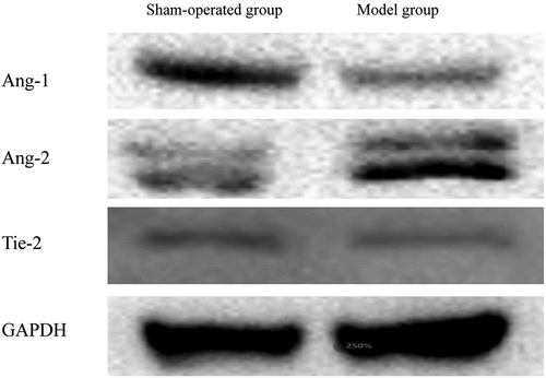 Figure 5. The expression of Ang-1, Ang-2, and Tie-2 assessed using Western blot analysis.