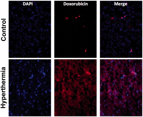 Figure 7. Fluorescence microscopy demonstrates localized doxorubicin delivery to tissue regions surrounding the hyperthermia probe (50 °C, 30 min).