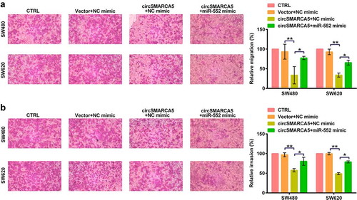 Figure 7. Participation of miR-552 in circSMARCA5-regulated colon cancer cell migration and invasion. SW480 and SW620 cells were transfected with circSMARCA5 overexpressing plasmid (or vector) and miR-552 mimic (or mimic NC). (a) Migration capacity assessed by Transwell assay. (b) Invasion capacity assessed by Matrigel Transwell assay. * p < 0.05, ** p < 0.01