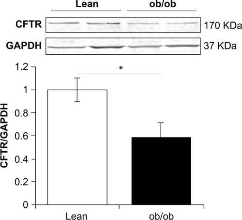 Figure 4 Total CFTR protein expression in murine jejunum. Typical Western blot demonstrating CFTR and GAPDH expression in jejunum from two samples, from both ob/ob and lean mice. CFTR and GAPDH bands were observed at ~170 KDa and 37 KDa, respectively.