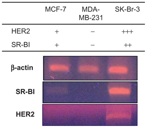 Figure 8 Reverse transcription polymerase chain reaction analysis of SR-BI and HER2 expression in MCF-7, MDA-MB-231, and SK-Br-3 cells.