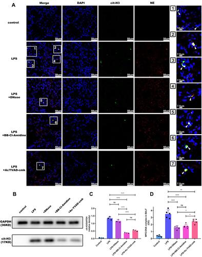 Figure 2 Alveolar macrophage pyroptosis inhibition reduces NET content in ARDS mice. Pulmonary instillation of LPS caused NET formation in mice, and NET levels were decreased in the Ac-YVAD, DNase I or BB-Cl-amidine plus LPS groups, as evidenced by immunofluorescence staining of lung sections for (A) Cit-H3 and NE, (B and C) Western blotting of lung tissues for cit-H3 and (D) measurement of the MPO-DNA complex level in BALF (n=5 mice). (*p<0.05, **p<0.01, ****p<0.0001).