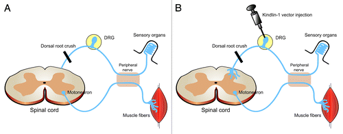 Figure 1. Schematic figure of the in vivo experiment by Tan and coworkers. (A) After a dorsal root crush, regrowing axons are halted at the interface between the dorsal root and spinal cord. (B) Injection of kindlin-1 viral vectors into the DRG allows growing axons to enter the spinal cord and sprout into the dorsal horn and -column of the spinal cord and leads to recovery of function.