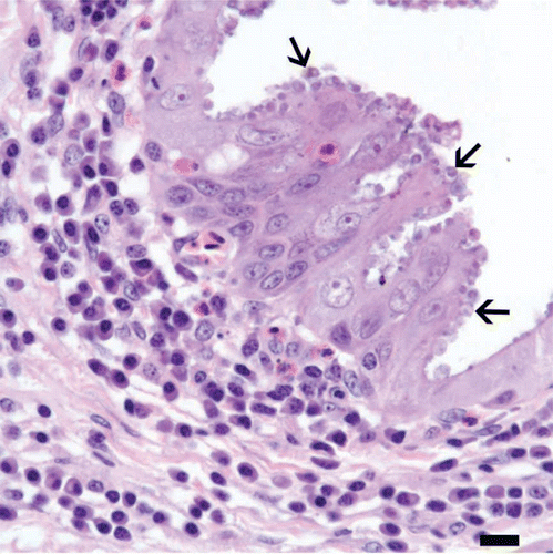 Figure 6.  Conjunctiva from a cliff swallow with conjunctivitis. Numerous, round protozoa 2 to 5 µm in diameter, consistent with cryptosporidial developmental stages (arrows), are located in or at the apical margins of epithelial cells along this segment of hyperplastic conjunctival epithelium. An infiltrate of plasma cells with occasional heterophils is present in the underlying connective tissue of the lamina propria. Bar = 10 µm. Haematoxylin and eosin.