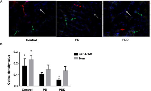 Figure 3. nAchRα7 and NeuN expression by immunofluorescence assay. (A) Images of immunofluorescence assay. NeuN (green fluorescence; green arrows); α7nAchR (red fluorescence; red arrows); and nuclei (blue; white arrows). (B) Relative expression of nAChRα7 protein/NeuN. *p < 0.05.