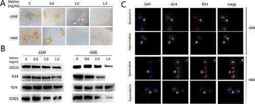 Figure 1. Matrine suppresses lung CSCs properties