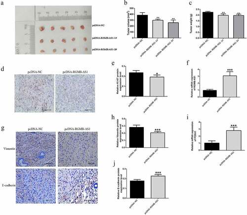 Figure 7. The effect of lncRNA RGMB-AS1 on FOXA1 xenograft growth in NPC nude mice. (a) Morphology of NPC transplanted tumor in nude mice; (b) The size of NPC transplanted tumor in nude mice; (c) Expression level of lncRNA RGMB-AS1 in NPC xenograft of nude mice; (d) The expression level of FOXA1 in NPC xenograft of nude mice; (e) The expression level of Ki-67 protein in NPC transplanted tumor tissue; (f) Immunohistochemical image of Ki-67 protein expression. (mean ± SD, n = 6; *P < 0.05, **P < 0.01).