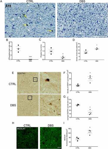 Figure 5. DBS reduces levels of phospho-MAPT/Tau and increases neuronal viability in PD patients. (A) Immunostaining of phospho-MAPT/Tau with AT8 antibody was performed in the GPi of PD patients who underwent STN stimulation (DBS, right panel; scale bar: 200 μm) or unstimulated controls (CTRL, left panel). Phospho-MAPT/Tau immunostaining is evident in somas (yellow arrows) and neurites (white arrow heads). (B) Quantification of AT8 immunostaining demonstrated about 100% decrease of phospho-MAPT/Tau positive somas in DBS patients compared to CTRL (n = 3; two-tailed unpaired t-test, ***p < 0.001). (C) Significant decrease, 0,3 ± 0,03 U/mL (-25 ± 3%), of phospho-MAPT/Tau Thr231 quantified by ELISA test in DBS-treated PD patients compared to CTRL (n = 3; two-tailed unpaired t-test, *p < 0.05). (D) A 5,12 ± 0,8/mm2 (+43 ± 7%) increased number of neurons was measured in DBS compared to CTRL GPi (n = 3; two-tailed unpaired t-test, *p < 0.05). (E) Immunostaining of SQSTM1/p62 in GPi of PD controls (CTRL, upper panels) and DBS (lower panels; scale bars: 100 μm; higher magnification: 25 μm). Higher magnification panels (right) show a 126 ± 42% increased number of SQSTM1 puncta (quantification in F; n = 3; two-tailed unpaired t-test, *p < 0.05), and a 16 ± 4% decreased size of puncta area (μm2) in DBS-stimulated neurons compared to control (quantification in G; n = 3; two-tailed unpaired t-test, *p < 0.05). (H, I) Immunofluorescence showing increased levels of MCOLN1 (+87 ± 20%) in the GPi of DBS-treated PD patients compared to CTRL (n = 3; two-tailed unpaired t-test, *p < 0.05; scale bar: 100 μm).