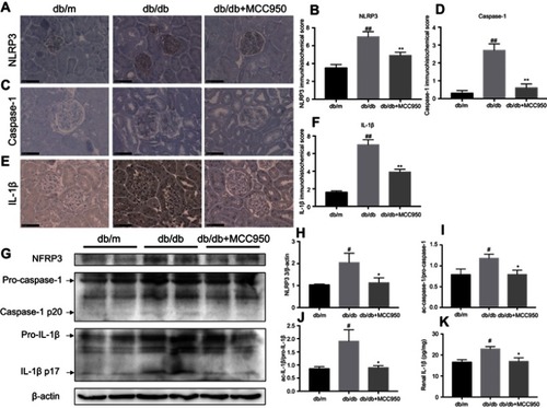 Figure 4 MCC950 inhibited diabetes-induced renal NLRP3 inflammasome activation in db/db mice.
